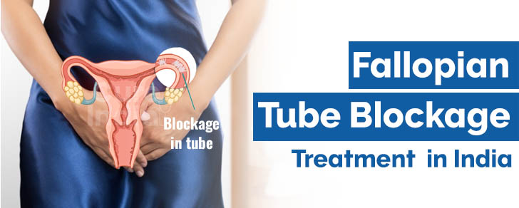Fallopian tube blockage treatment